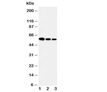 Western blot testing of Fetuin-A antibody and Lane 1: recombinant human protein 10ng; 2: 5ng; 3: 2.5ng