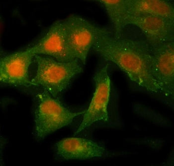 Immunofluorescent staining of FFPE human A549 cells with NBR1 antibody (red) and Beta Tubulin mAb (green). HIER: steam section in pH6 citrate buffer for 20 min.