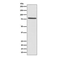 Western blot testing of human HeLa cell lysate with Ezrin antibody. Expected molecular weight: 70-80 kDa.