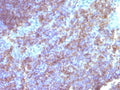 IHC staining of FFPE human tonsil tissue with CD45 antibody. HIER: boil tissue sections in pH 9 10mM Tris with 1mM EDTA for 20 min and allow to cool before testing.