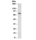Western blot testing of HeLa lysate with Transglutaminase 4 antibody at 1ug/ml. Predicted molecular weight: ~77kDa.