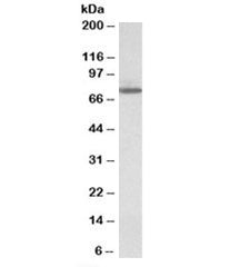 Western blot testing of HeLa lysate with Transglutaminase 4 antibody at 1ug/ml. Predicted molecular weight: ~77kDa.
