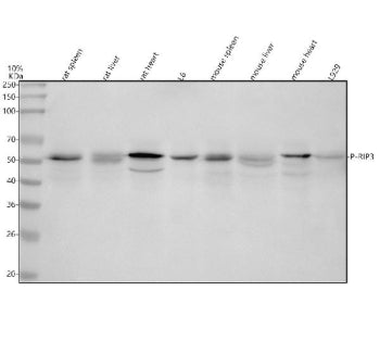 Western blot analysis of Phospho-RIP3 (S232) using anti-Phospho-RIP3 (pS232) antibody. Lane 1: rat spleen tissue lysates, Lane 2: rat liver tissue lysates, Lane 3: rat heart tissue lysates, Lane 4: rat L6 whole cell lysates, Lane 5: mouse spleen tissue lysates, Lane 6: mouse liver tissue lysates, Lane 7: mouse heart tissue lysates, Lane 8: mouse L929 whole cell lysates. After electrophoresis, proteins were transferred to a nitrocellulose membrane at 150 mA for 50-90 min.