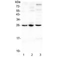 Western blot testing of 1) mouse lung, 2) mouse spleen and 3) rat spleen lysate with Trem1 antibody at 0.5ug/ml. Predicted molecular weight: 26-30 kDa depending on glycosylation level.