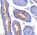 Immunohistochemical staining of PICK1 using anti-PICK1 antibody. PICK1 was detected in a paraffin-embedded section of mouse testis tissue. Heat mediated antigen retrieval was performed in EDTA buffer (pH 8.0, epitope retrieval solution). The tissue section was blocked with 10% goat serum. The tissue section was then incubated with 2 ug/ml rabbit anti-PICK1 antibody overnight at 4oC. Peroxidase Conjugated Goat Anti-rabbit IgG was used as secondary antibody and incubated for 30 min at 37oC.