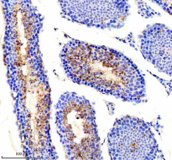 Immunohistochemical staining of PICK1 using anti-PICK1 antibody. PICK1 was detected in a paraffin-embedded section of mouse testis tissue. Heat mediated antigen retrieval was performed in EDTA buffer (pH 8.0, epitope retrieval solution). The tissue section was blocked with 10% goat serum. The tissue section was then incubated with 2 ug/ml rabbit anti-PICK1 antibody overnight at 4oC. Peroxidase Conjugated Goat Anti-rabbit IgG was used as secondary antibody and incubated for 30 min at 37oC.