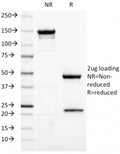SDS-PAGE analysis of purified, BSA-free Estrogen Receptor alpha antibody (ESR1/420) as confirmation of integrity and purity.