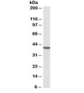 Western blot testing of rat heart lysate with CTnT antibody at 0.03ug/ml