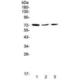 Western blot testing of human 1) HeLa, 2) MCF7 and 3) A375 cell lysate with TORC2 antibody at 0.5ug/ml. Predicted molecular weight ~73 kDa.