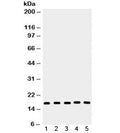 Western blot testing of 1) rat lung, 2) mouse liver, 3) human A549, 4) PANC and 5) 293 lysate with Caspase-2 antibody. Predicted molecular weight: ~47 kDa (full), ~31 kDa (large+small subunit), ~11 kDa (small subunit).