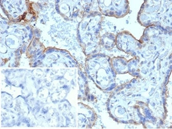 IHC staining of FFPE human placenta with MMP3 antibody. HIER: boil tissue sections in pH 9 10mM Tris with 1mM EDTA for 20 min and allow to cool before testing. Negative control inset: PBS used instead of primary antibody to control for secondary Ab binding.