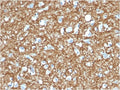 IHC testing of FFPE human brain with p14ARF antibody (clone 4C6/4). HIER: boil tissue sections in pH6, 10mM citrate buffer, for 10-20 min followed by cooling at RT for 20 min.