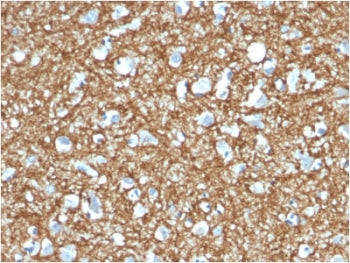 IHC testing of FFPE human brain with p14ARF antibody (clone 4C6/4). HIER: boil tissue sections in pH6, 10mM citrate buffer, for 10-20 min followed by cooling at RT for 20 min.
