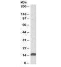 Western blot testing of human heart lysate with NDUFS6 antibody at 0.01ug/ml. Predicted molecular weight: ~14kDa.