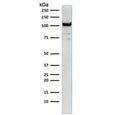 Western blot testing of human Jurkat cell lysate with CD31 antibody (clone C31.1). Expected molecular weight: 83-130 kDa depending on level of glycosylation.