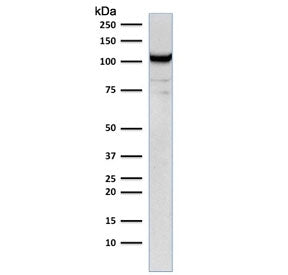 Western blot testing of human Jurkat cell lysate with CD31 antibody (clone C31.1). Expected molecular weight: 83-130 kDa depending on level of glycosylation.