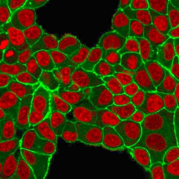 Immunofluorescent staining of PFA-fixed human MCF-7 cells with HER2 antibody (green) and Reddot nuclear stain (red).
