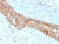 IHC staining of FFPE human colon tissue with CD56 antibody (clone rNCAM1/8655). HIER: boil tissue sections in pH 9 10mM Tris with 1mM EDTA for 20 min and allow to cool before testing.