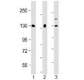 Western blot testing of human 1) U-87 MG, 2) HeLa and 3) BxPC-3 cell lysate with MGEA5 antibody at 1:2000. Predicted molecular weight ~103 kDa, routinely observed at ~130 kDa (cytoplasmic form) and ~75 kDa (MGEA5s/nuclear form).