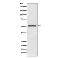 Western blot testing of human A375 cell lysate with MITF antibody. Predicted molecular weight: 55-60 kDa.