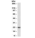 Western blot testing of human testis lysate with MRGBP antibody at 0.3ug/ml. Predicted molecular weight: ~22kDa.