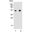 Western blot testing of 1) mouse stomach and 2) rat stomach lysate with CTSE antibody. Predicted molecular weight ~43 kDa.