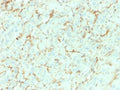 IHC testing of FFPE human adrenal gland with NGF Receptor antibody (clone NGFR/1964). HIER: boil tissue sections in pH6, 10mM citrate buffer, for 10-20 min followed by cooling at RT for 20 min.