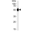 Western blot testing of human blood plasma lysate with Serpin C1 antibody. Predicted molecular weight ~52 kDa.