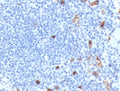 IHC staining of FFPE human tonsil tissue with recombinant IgM antibody (clone MuHC2-2R). HIER: boil tissue sections in pH 9 10mM Tris with 1mM EDTA for 10-20 min and allow to cool before testing.