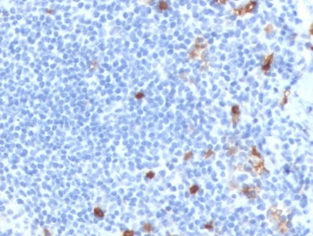 IHC staining of FFPE human tonsil tissue with recombinant IgM antibody (clone MuHC2-2R). HIER: boil tissue sections in pH 9 10mM Tris with 1mM EDTA for 10-20 min and allow to cool before testing.