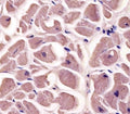 IHC staining of FFPE human heart tissue with Myosin-binding protein C antibody. HIER: steam section in pH6 citrate buffer for 20 min and allow to cool prior to staining.