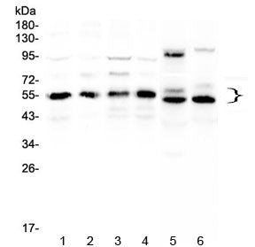 Western blot testing of human 1) HeLa, 2) COLO320, 3) A431, 4) MCF7, 5) rat heart and 6) mouse heart lysate with RXRA antibody at 0.5ug/ml. Predicted molecular weight: ~51 kDa but routinely observed at 54~60 kDa.