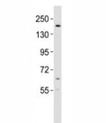 Western blot testing of KDM6B antibody at 1:2000 dilution + mouse lung lysate; Predicted molecular weight ~176 kDa.