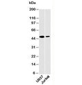 Western blot testing of human samples with DC-SIGN antibody at 2ug/ml. Predicted molecular weight ~46 kDa.