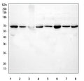 Western blot testing of 1) human SiHa, 2) human HeLa, 3) human RT4, 4) human A549, 5) rat brain, 6) rat PC-12, 7) mouse brain and 8) mouse NIH 3T3 cell lysate with AMPK alpha 1 antibody. Predicted molecular weight ~63 kDa.