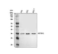 Western blot analysis of Meteorin-like/METRNL using anti-METRNL antibody. Lane 1: human Hela whole cell lysates, Lane 2: human HEL whole cell lysates, Lane 3: human MCF-7 whole cell lysates. After electrophoresis, proteins were transferred to a nitrocellulose membrane at 150 mA for 50-90 min. Blocked the membrane with 5% non-fat milk/TBS for 1.5 hour at RT.