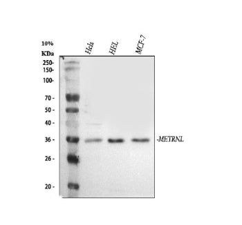 Western blot analysis of Meteorin-like/METRNL using anti-METRNL antibody. Lane 1: human Hela whole cell lysates, Lane 2: human HEL whole cell lysates, Lane 3: human MCF-7 whole cell lysates. After electrophoresis, proteins were transferred to a nitrocellulose membrane at 150 mA for 50-90 min. Blocked the membrane with 5% non-fat milk/TBS for 1.5 hour at RT.