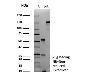 SDS-PAGE analysis of purified, BSA-free recombinant PAX6 antibody (clone rPAX6/9324) as confirmation of integrity and purity.