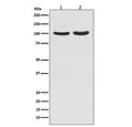 Western blot testing of human 1) T-47D and 2) LNCaP cell lysate with Androgen Receptor antibody. Predicted molecular weight ~99 kDa.
