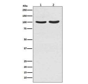Western blot testing of human 1) T-47D and 2) LNCaP cell lysate with Androgen Receptor antibody. Predicted molecular weight ~99 kDa.