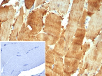IHC staining of FFPE human skeletal muscle tissue with Carbonic Anhydrase 3 antibody (clone CA3/7884). Inset: PBS used in place of primary Ab (secondary Ab negative control). HIER: boil tissue sections in pH 9 10mM Tris with 1mM EDTA for 20 min and allow to cool before testing.
