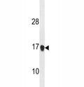 Anti-p21 antibody western blot analysis in mouse NIH3T3 lysate