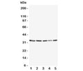 Western blot testing of TNFAIP8L3 antibody and Lane 1: MCF-7; 2: SW620; 3: COS7; 4: SKOV; 5: Jurkat lysate. Predicted/observed size ~33KD