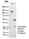 SDS-PAGE analysis of purified, BSA-free recombinant IL1 beta antibody (clone IL1B/7049R) as confirmation of integrity and purity.