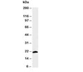 Western blot testing of Myosin antibody and rat skeletal muscle tissue lysate