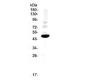 Western blot testing of rat PC-12 cell lysate with CCR1 antibody at 0.5ug/ml. Predicted molecular weight 40-45 kDa.