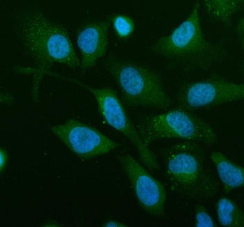 Immunofluorescent staining of Renin receptor/ATP6AP2 using anti-Renin receptor antibody (green). Renin receptor/ATP6AP2 was detected in an immunocytochemical section of human HeLa cells. Enzyme antigen retrieval was performed using IHC enzyme antigen retrieval reagent for 15 mins. The cells were blocked with 10% goat serum. And then incubated with 5 ug/ml rabbit anti-Renin receptor antibody overnight at 4oC.