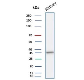 Western blot testing of human kidney tissue lysate with recombinant Napsin A antibody. Expected molecular weight: 38-45 kDa.