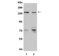 Western blot testing of human 1) LNCaP and 2) SGC-7901 lysate with CDH2 antibody. Predicted molecular weight ~100 kDa (unmodified), 125-140 kDa (modified).