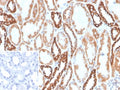 IHC staining of FFPE human kidney tissue with Phospholipase A2 receptor 1 antibody (clone PLA2R1/4894). Inset: PBS used in place of primary Ab (secondary Ab negative control). HIER: boil tissue sections in pH 9 10mM Tris with 1mM EDTA for 20 min and allow to cool before testing.